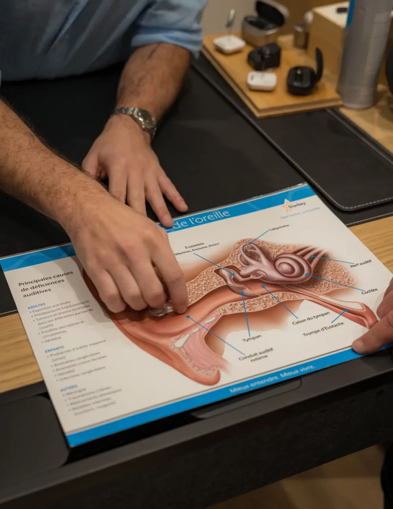 appareil haut de gamme audioprothesite